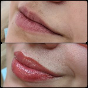 Before and After Photo for Lip Blush Tattoo