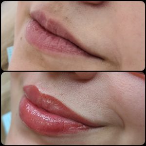 Before and After Photo for lip blush tattoo