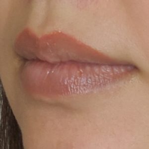 Dark lip correction and neutralization