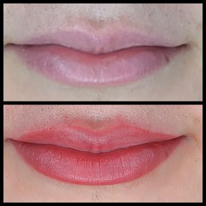 before and after photo of lip blush
