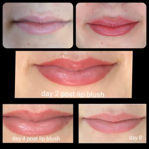 before and after photo of lip blush