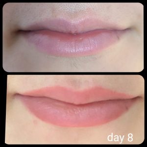before and after photo of lip blush