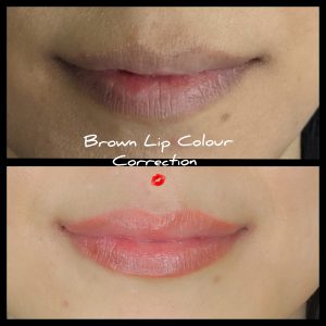 before and after photo of lip blush