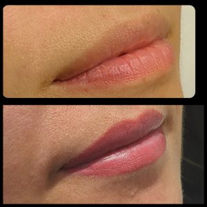 before and after photo of lip blush